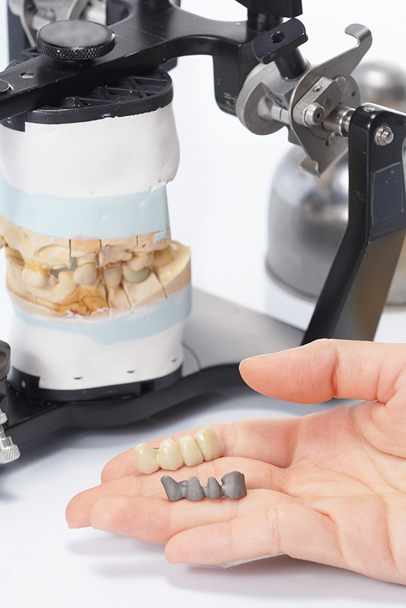 Dentist holding dental bridges in his hand