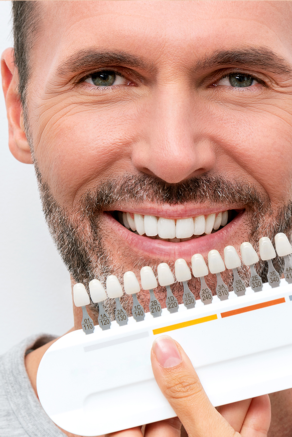 Man with tooth colored guide to match tooth filling.