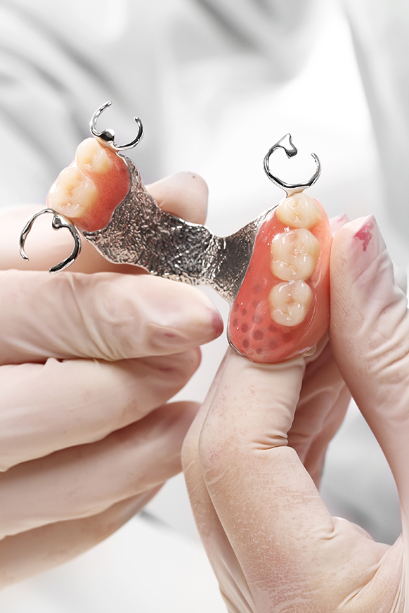 Dentist in Miami holding a prosthetic dental device. 