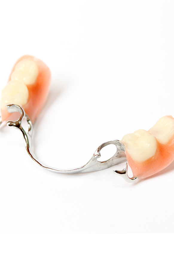 Partial dentures