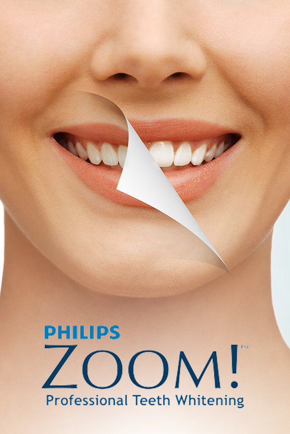 Teethwhitening concept woman mouth with before and after teethwhiteing.